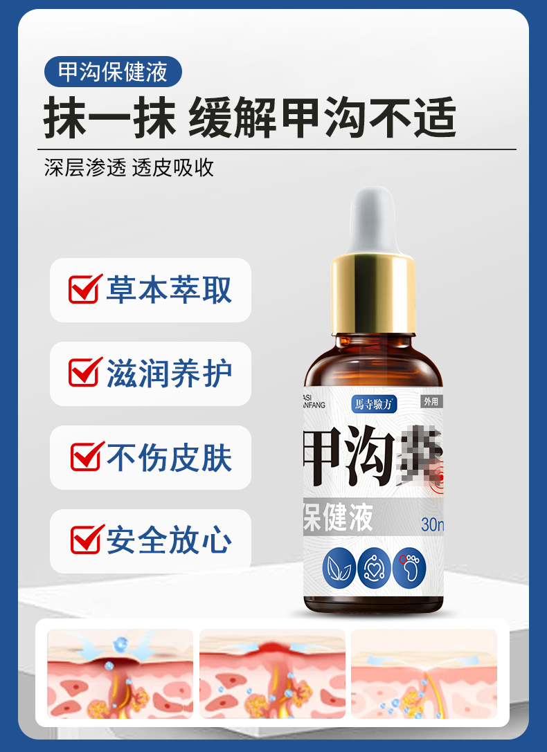 抹一抹，緩解甲溝不適